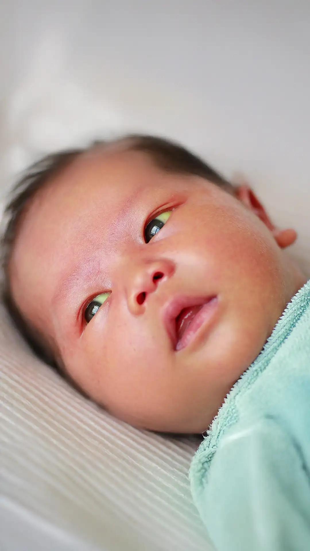 Bayi Kuning